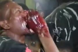 Populares Comendo Carne de Cadáver Após Linchamento na África