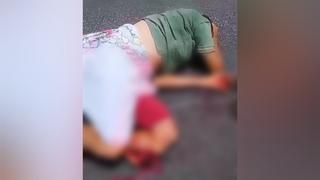 Motociclista sofre acidente e tem fratura exposta na perna na BR-101