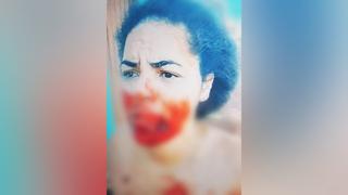 Briga entre mulheres termina em mordida brutal no Maranhão