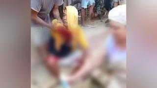 Homem perde o braço em acidente de trabalho em mina na Colômbia