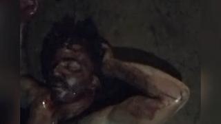 Homem é ferido ao tentar invadir residência armado com faca em Presidente Figueiredo -AM
