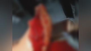 Homem sofre grave acidente de trabalho com roçadeira em Sena Madureira