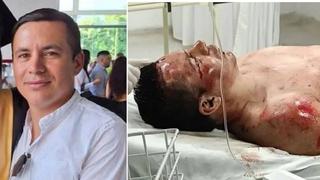 Pastor é Espancado e Preso Após Estuprar Enteada de 13 Anos na Colômbia
