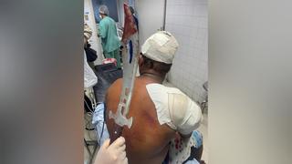 Homem dá entrada em hospital com espada cravada no ombro na Bahia