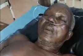 Idoso dá entrada em hospital com ferimento grave após assalto em Enugu, na Nigéria