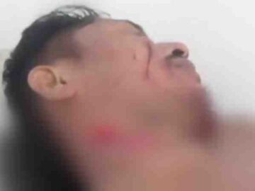 Briga entre dois homens termina com feridos em comunidade rural de Breves