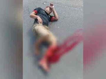 Motociclista sofre fratura exposta após acidente entre Alagoa Grande e Juarez Távora